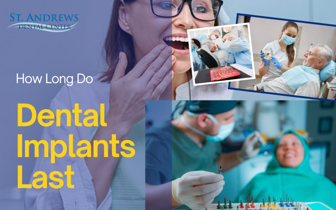 How Long Do Dental Implants Last? A Guide to Lifelong Smiles