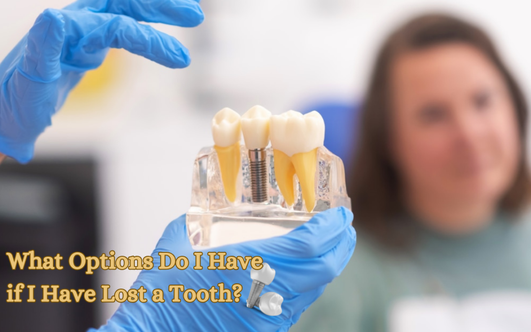 What Options Do I Have if I Have Lost a Tooth?