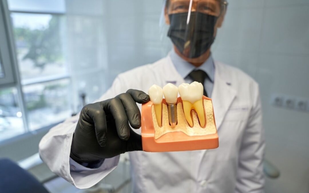 Are Dental Implants Worth It? Benefits, Cost & Long-Term Value