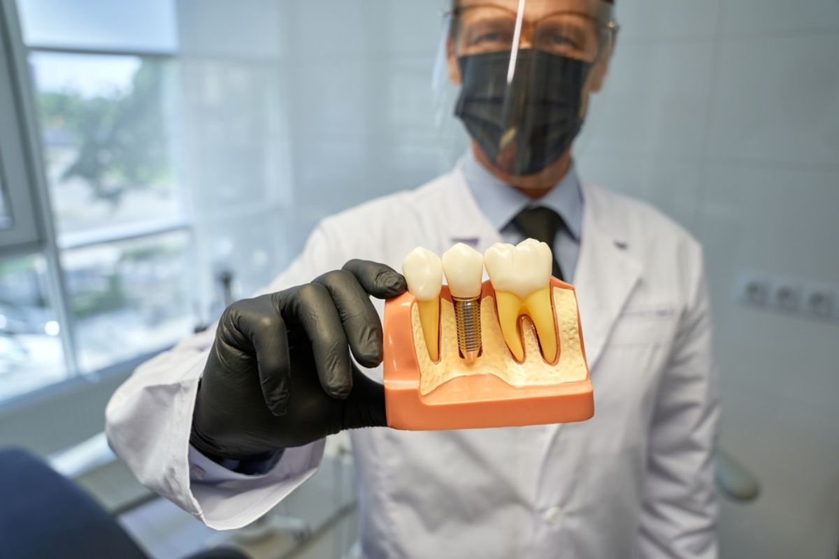 dental implants dental implants in Panama City