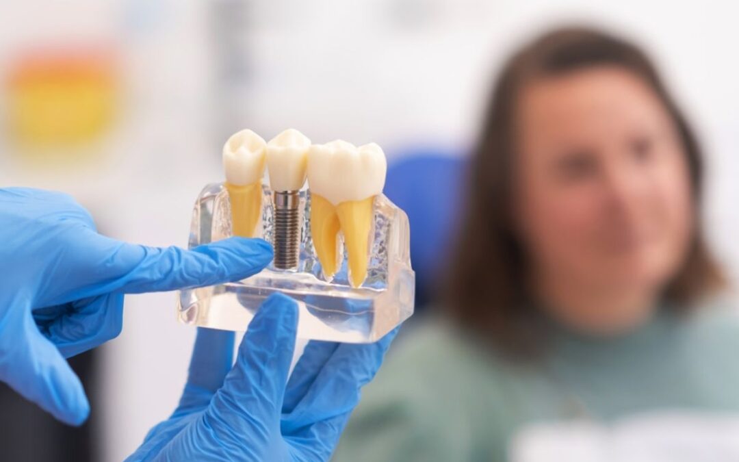 How Do You Choose the Right Implant Dentist?