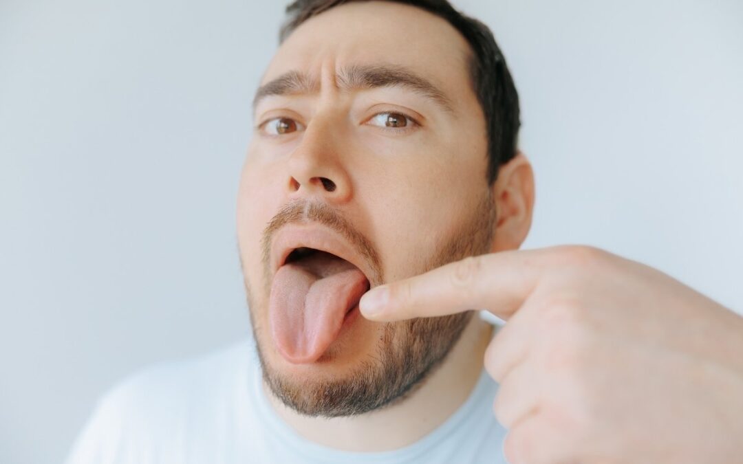 Burning on the Tip of Your Tongue? Here’s What to Do