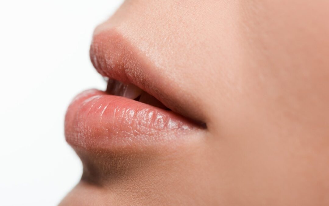 Why Your Lip is Swollen and How to Treat It?