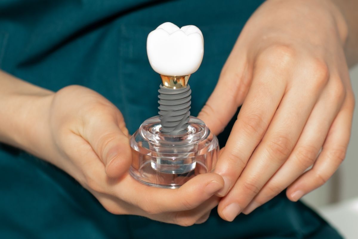 dental implants modul in hand dental implants modul in hand