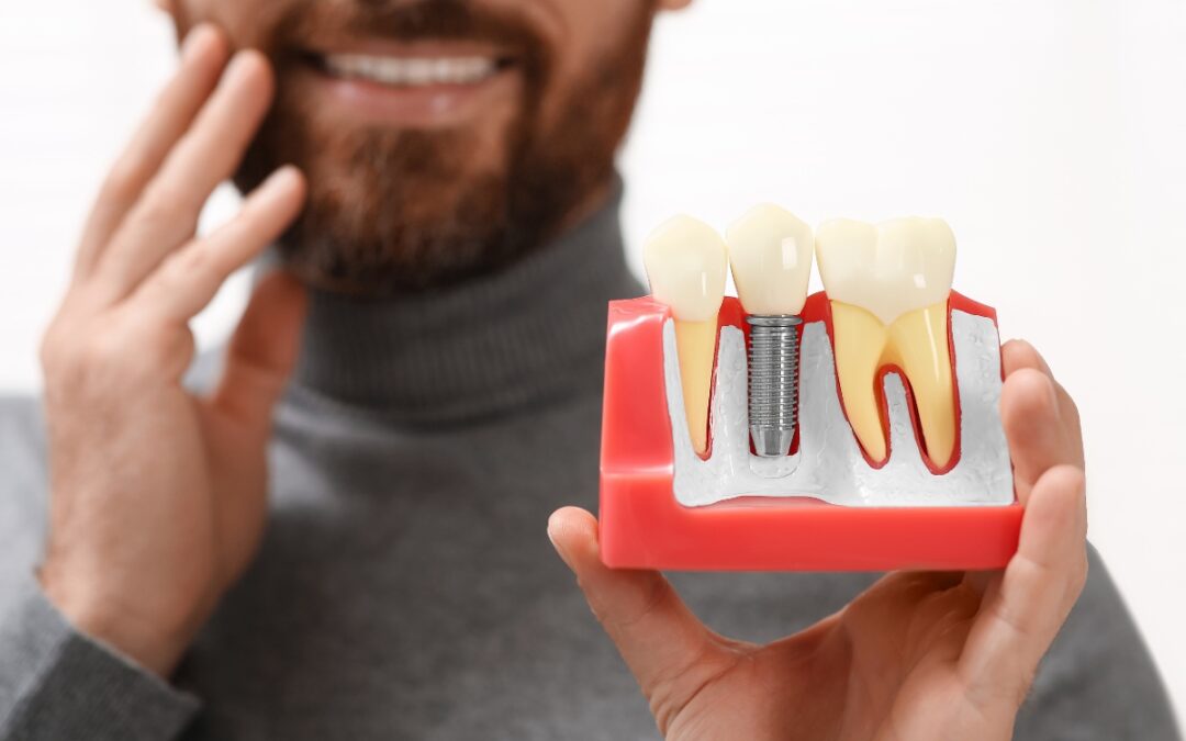 Are Dental Implants Safe for Seniors? What Older Adults Should Know