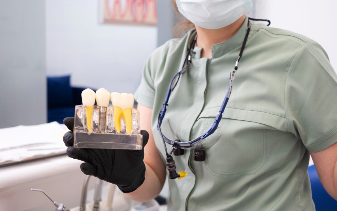 Why Dental Implants Are Considered the Gold Standard for Tooth Replacement