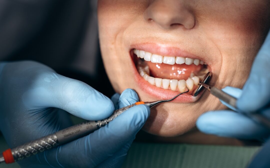 Why Routine Dental Visits Are More Important Than You Realize in Panama City