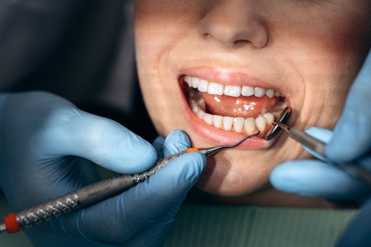 Routine Dental Visits